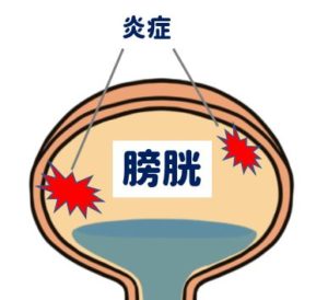 猫の膀胱炎】フードは変えるべき？おすすめのフードはどれ？ - 療法食 