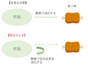 犬の膵炎 食事のポイントとおすすめフード5選を栄養士が解説 療法食チャンネル